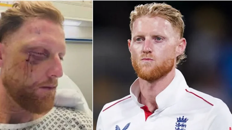 బెన్ స్టోక్స్ ఫేషియల్ సర్జరీ.. అంత అవసరం ఏమొచ్చింది ?!